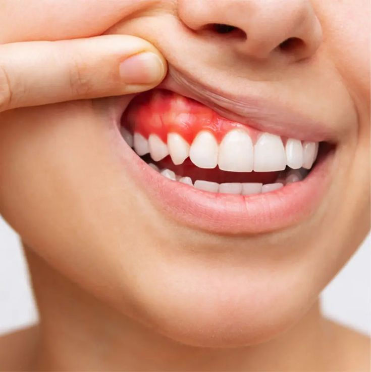 periodoncia 